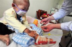 “白血病”兒童增加，甲醛危害值得關(guān)注